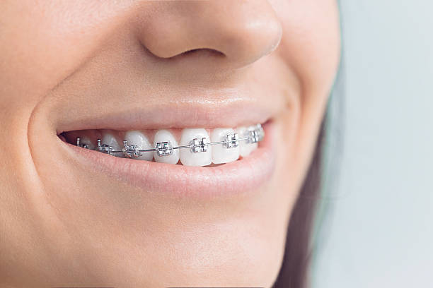 Best Teeth Whitening  in Fremont, CA